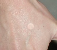 Scar 3